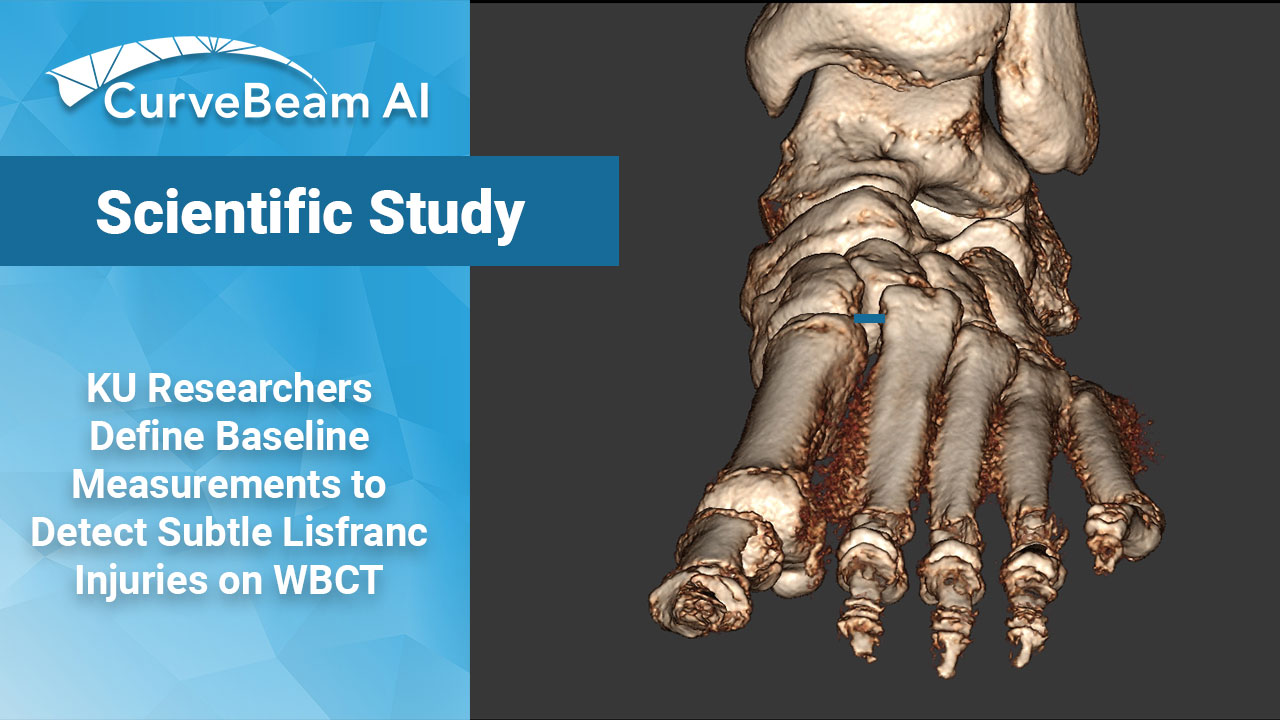 Lisfranc-Study