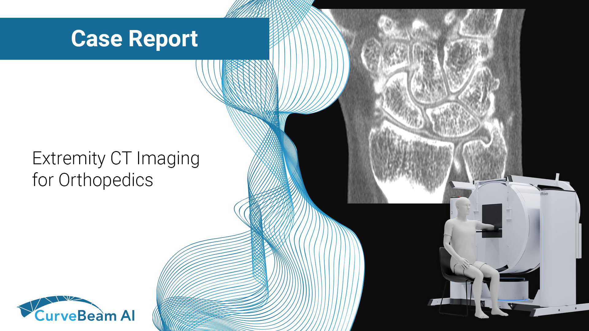 Extremity-CT-Imaging-for-Orthopedics